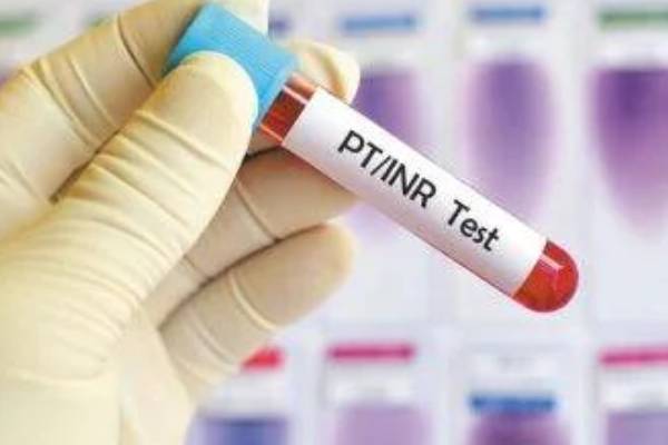 چه آزمایشی برای تشخیص سکته قلبی تجویز می‌شود؟