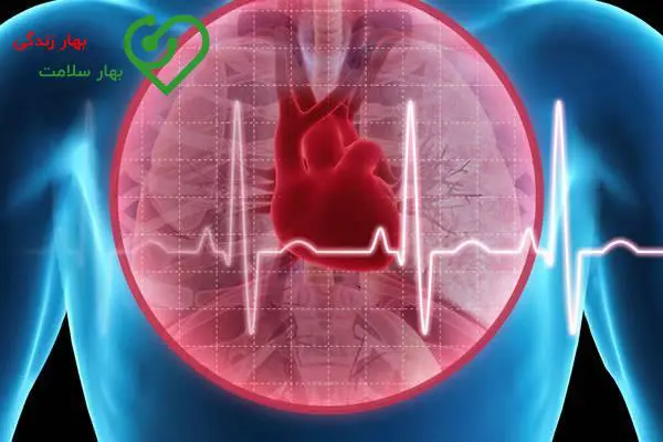 انژیوگرافی بعد از سکته قلبی