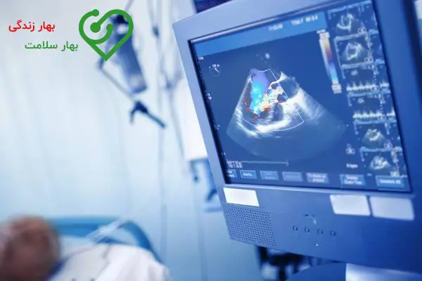 اسکن قلب بهتر است یا تست ورزش اسکن قلب بهتر است یا تست ورزش