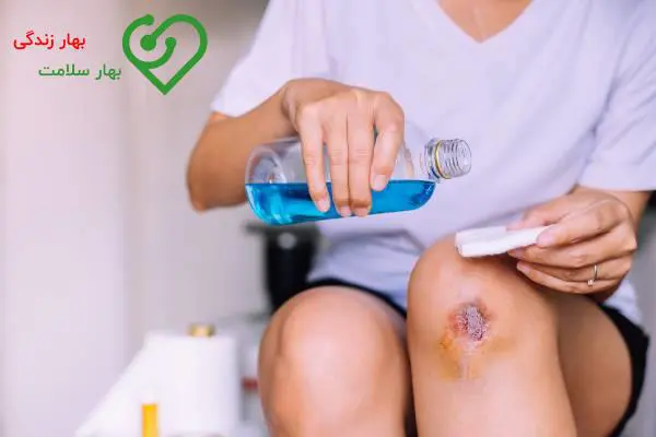 یک زخم را چه طور باید درمان کرد تا جای آن بهتر و سریعتر خوب شود؟