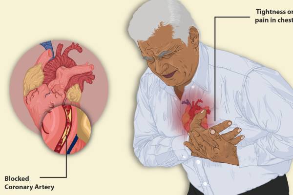 آیا قلب درد عصبی خطرناک است