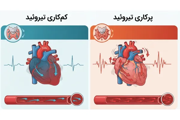 پرکاری و کم‌کاری تیروئید چگونه بر قلب تأثیر می‌گذارند؟