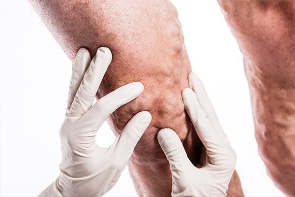 معرفی بهترین دکتر واریس پا و معتبرترین مرکز درمانی واریس