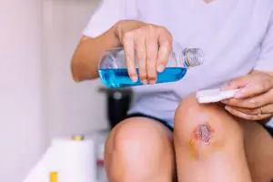 راه های درمان انواع زخم های پوستی سطحی و عمیق