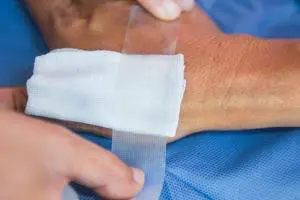 درمان زخم عفونی در خانه با بهترین روش‌‌های جدید