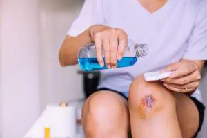 یک زخم را چه طور باید درمان کرد تا جای آن بهتر و سریعتر خوب شود؟