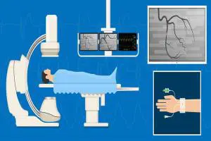 هزینه آنژیوگرافی قلب آپدیت تیر 1403