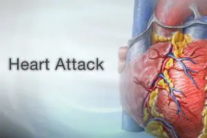 چگونه درد قلب را کاهش دهیم؟ (13 درمان فوری قلب درد در منزل)