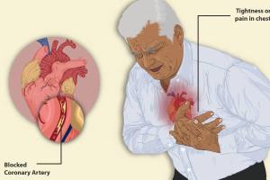 آیا قلب درد عصبی خطرناک است