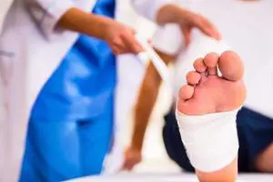 مدت زمان درمان زخم پای دیابتی