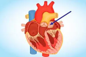 نارسایی قلبی؛ شناخت علت و درمان (تایید شده توسط پزشک)